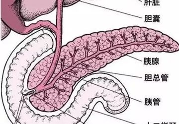 七旬老人突发急性重症胰腺炎 清远市中医院微创手术成功获救